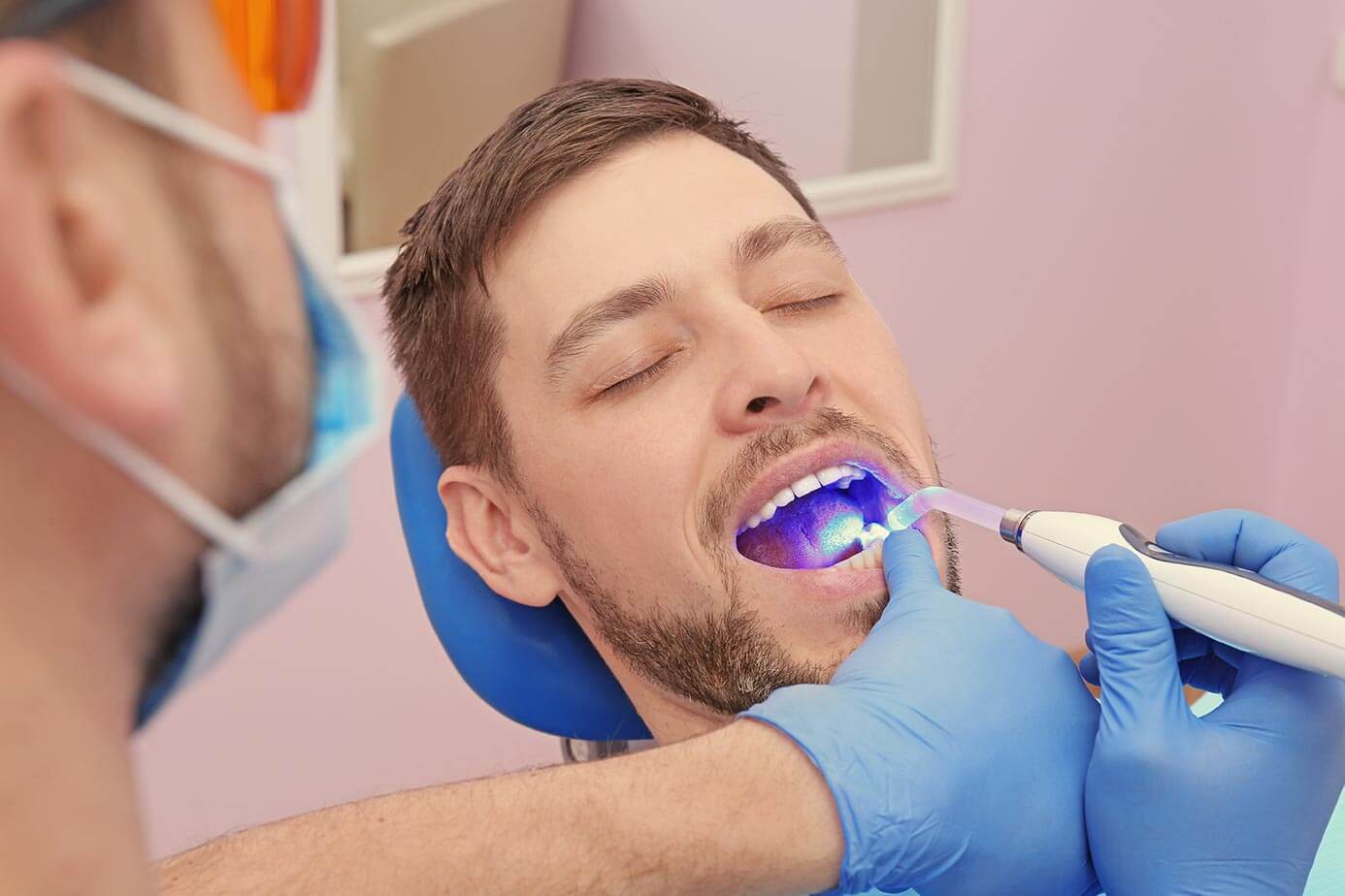 Dental fillings