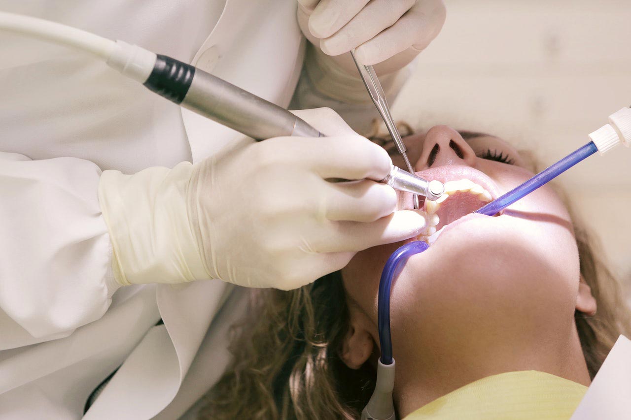 Dental Work Dental Work