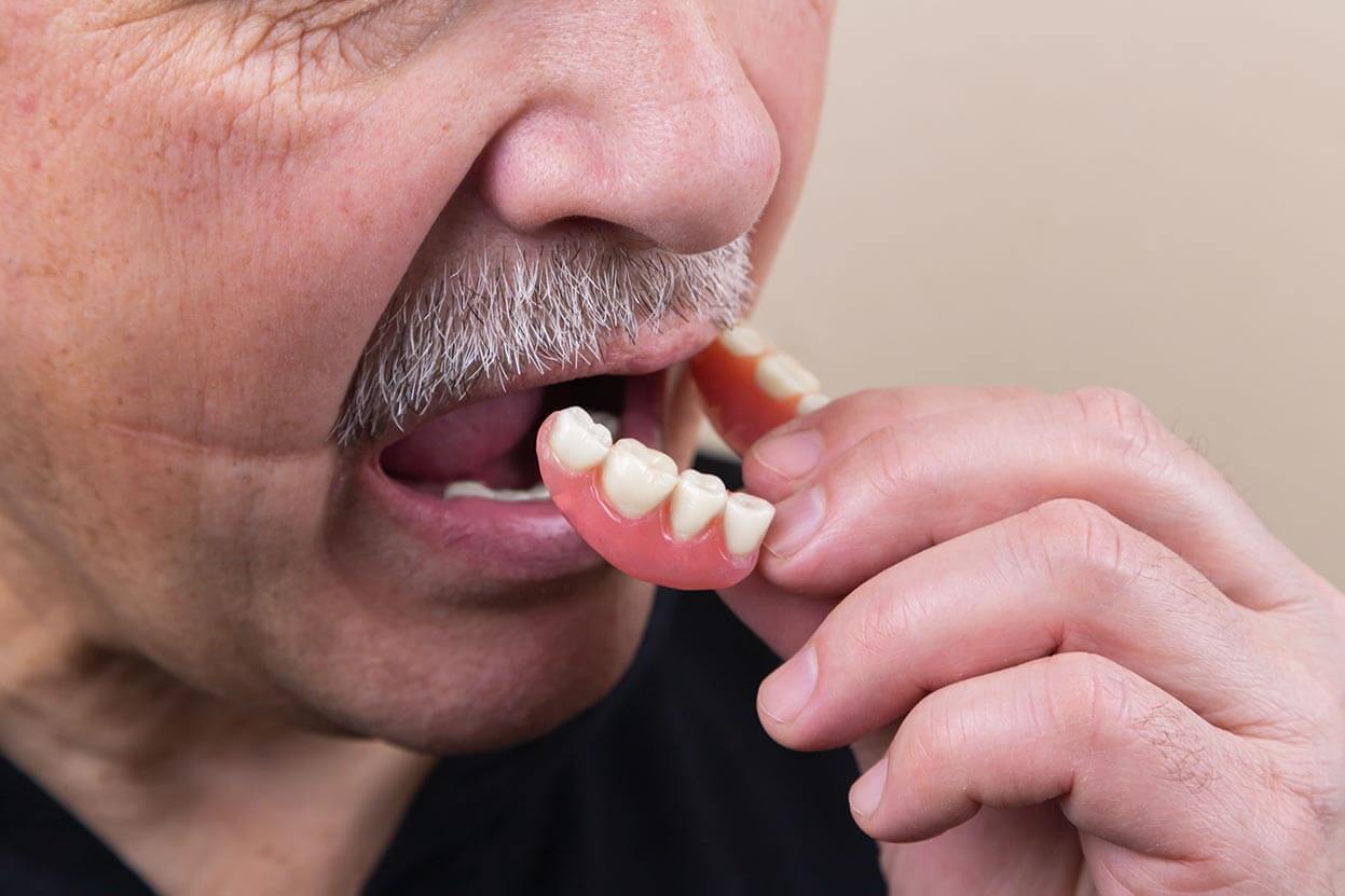 Man Inserting Dentures Man Inserting Dentures